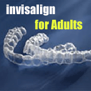 invisalign
