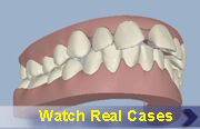 Cases