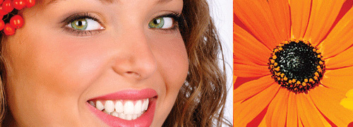 vancouver invisalign