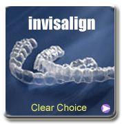 invisalign