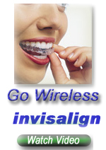 Invisalign